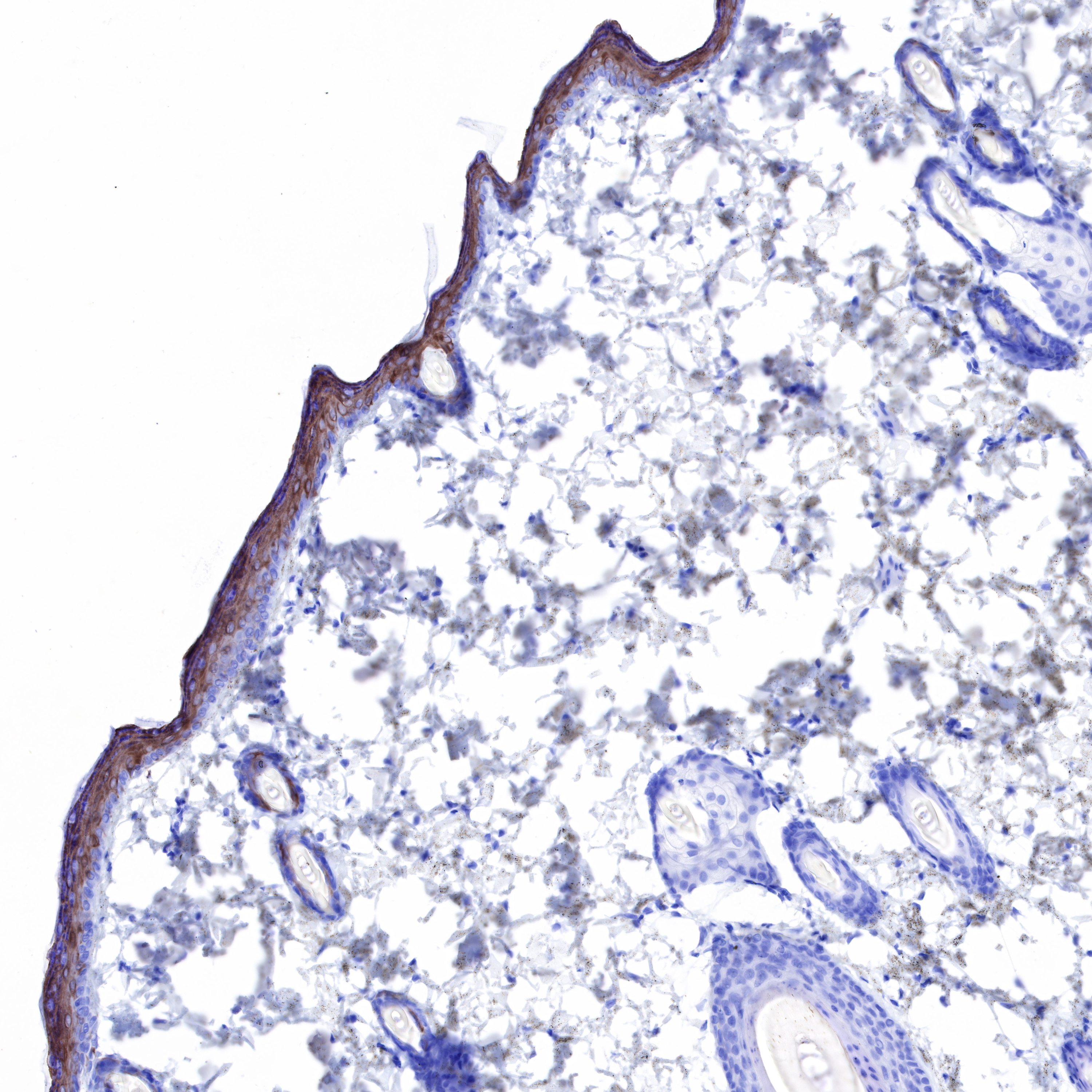 Rabbit anti-Keratin 10 Recombinant Monoclonal Antibody(R067)