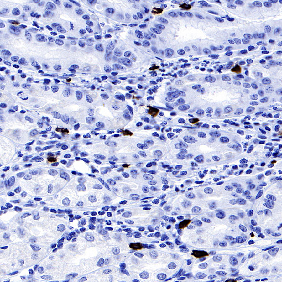 Rabbit anti-TPSAB1 Recombinant Monoclonal Antibody(R038)