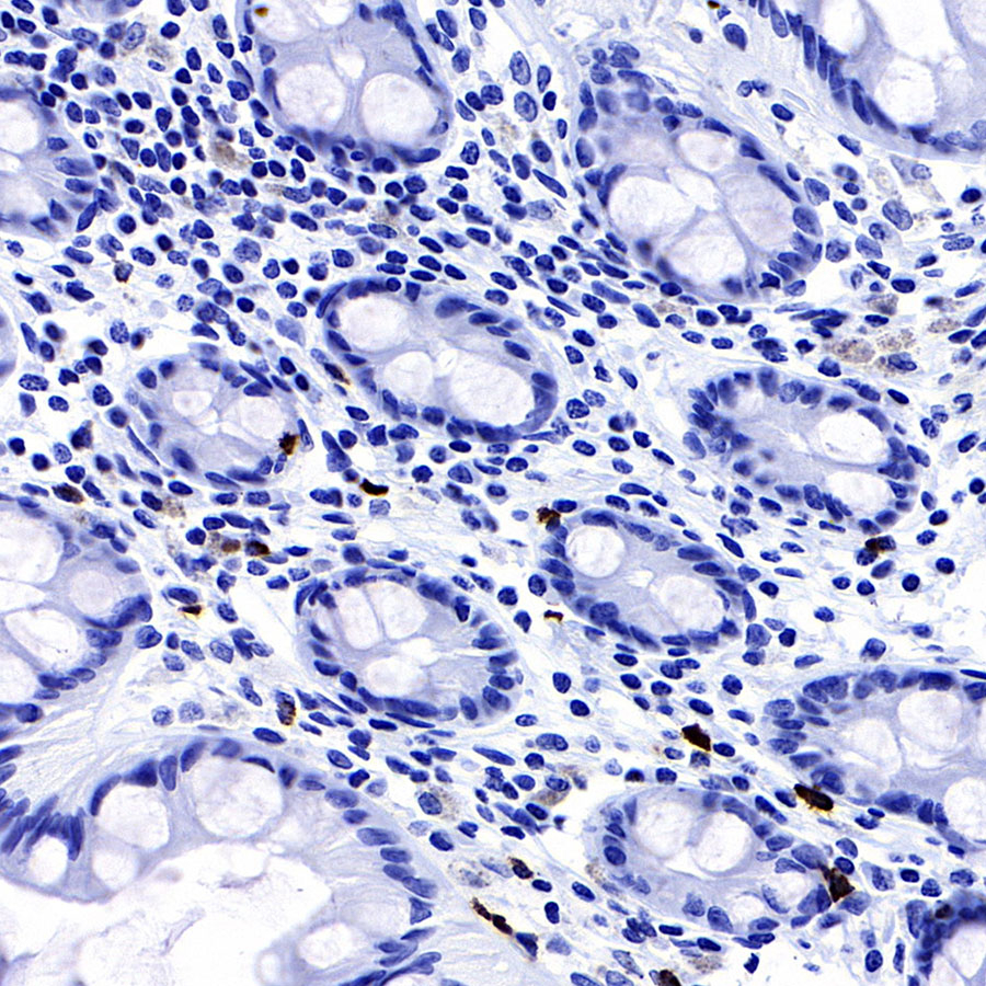 Rabbit anti-TPSAB1 Recombinant Monoclonal Antibody(R038)