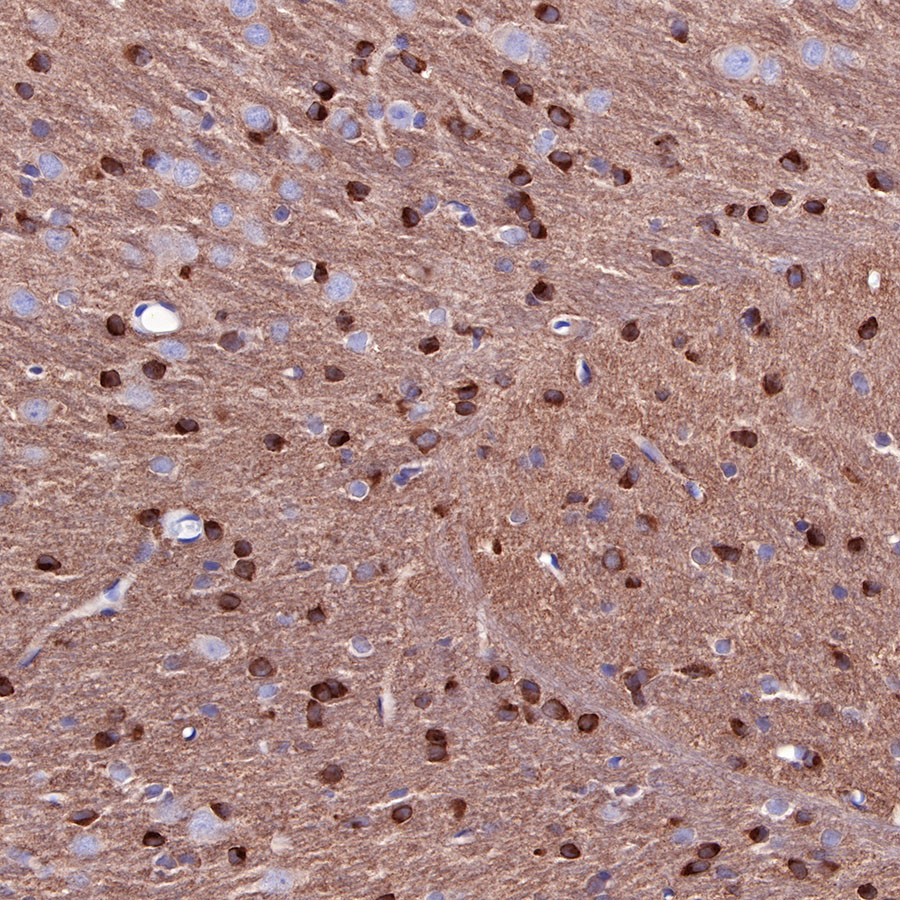 Rabbit anti-Tau Recombinant Monoclonal Antibody(171-67)
