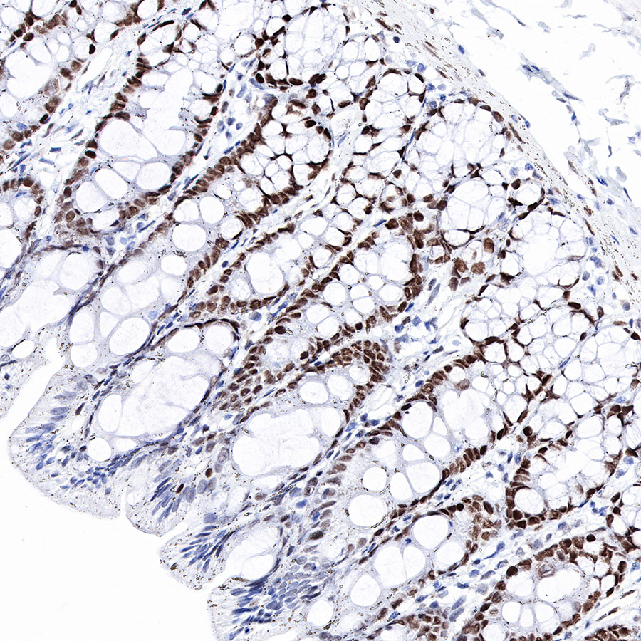 Rabbit anti-FOXP1 Recombinant Monoclonal Antibody(R053)