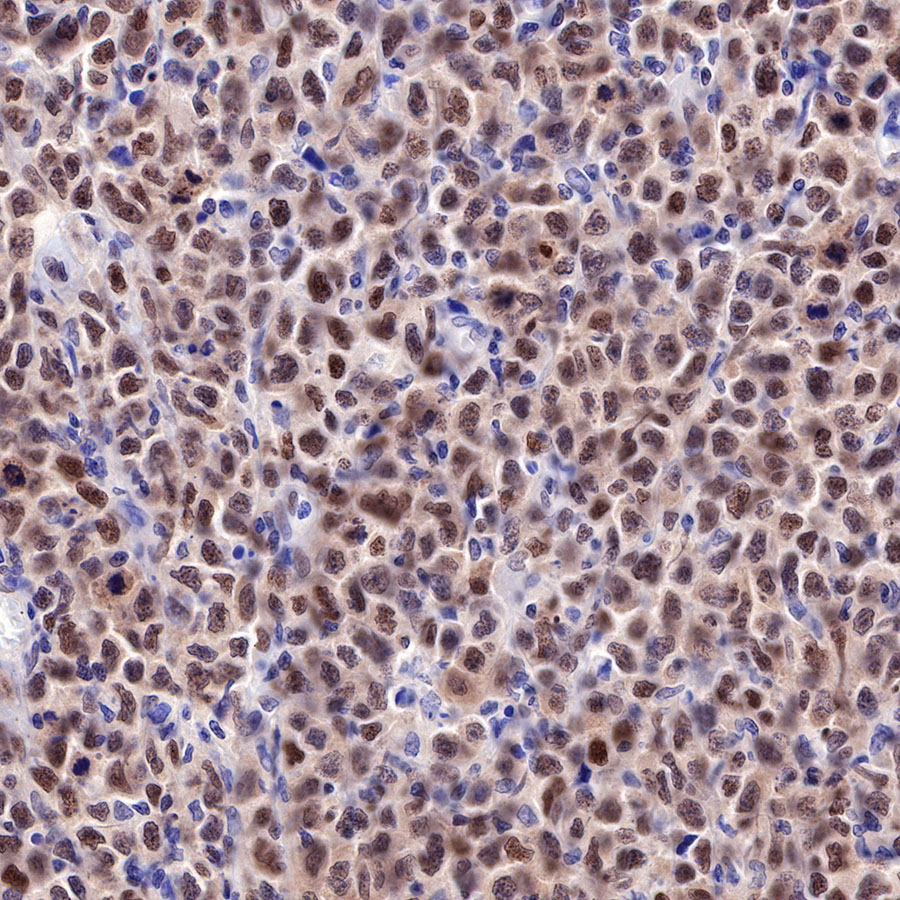 Rabbit anti-FOXP1 Recombinant Monoclonal Antibody(R053)