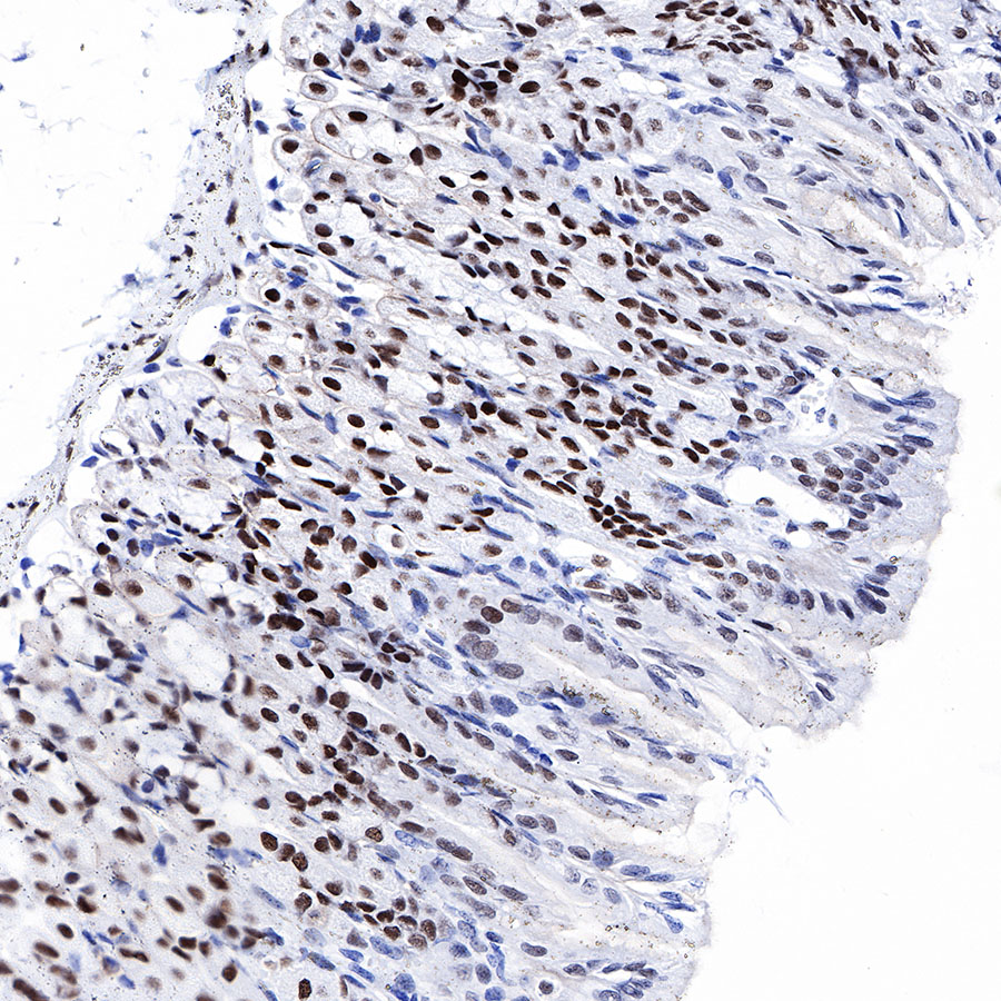 Rabbit anti-FOXP1 Recombinant Monoclonal Antibody(R053)