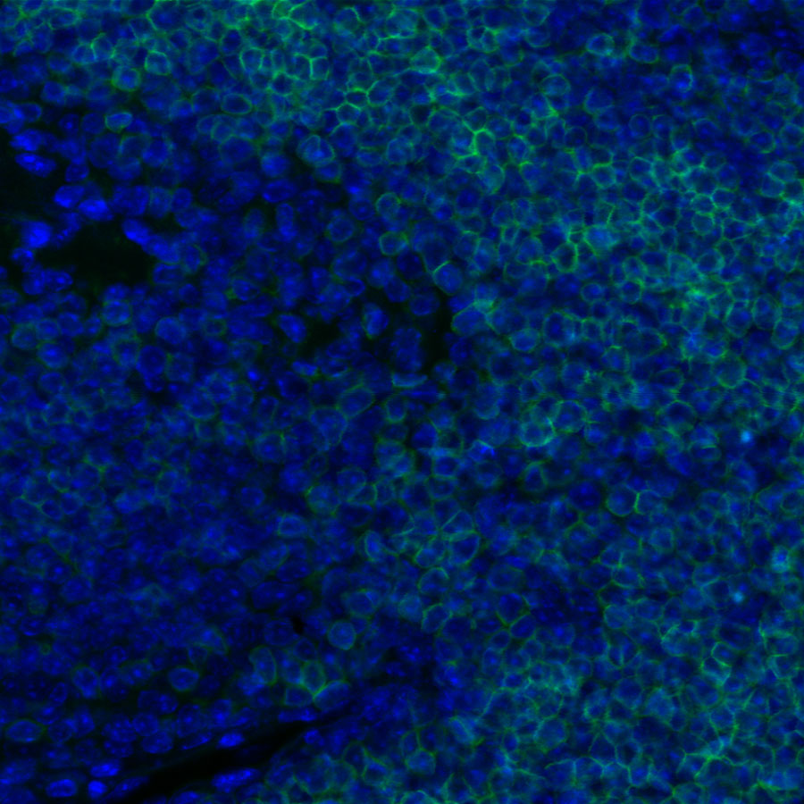 Rabbit anti-CD8α Recombinant Monoclonal Antibody(142-52)
