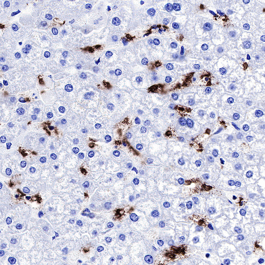 Rabbit anti-GLUT1 Recombinant Monoclonal Antibody(R057)