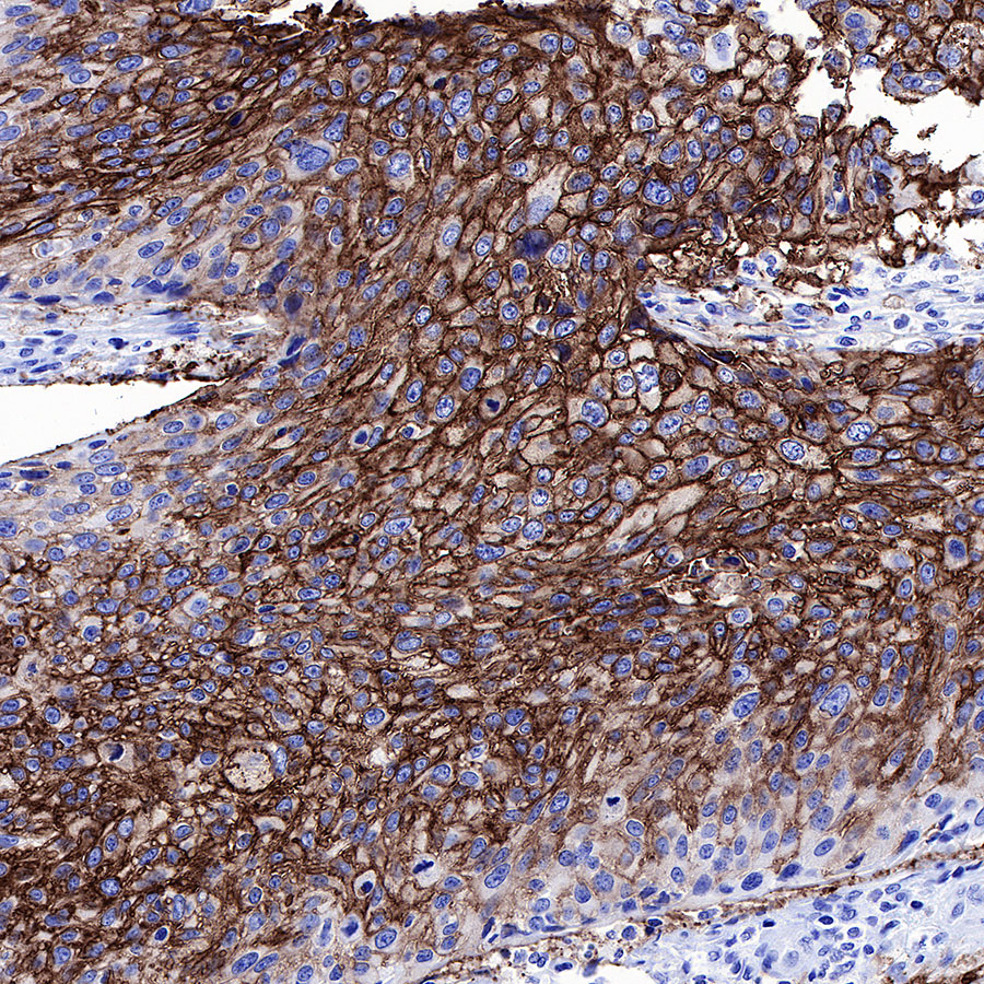 Rabbit anti-GLUT1 Recombinant Monoclonal Antibody(R057)