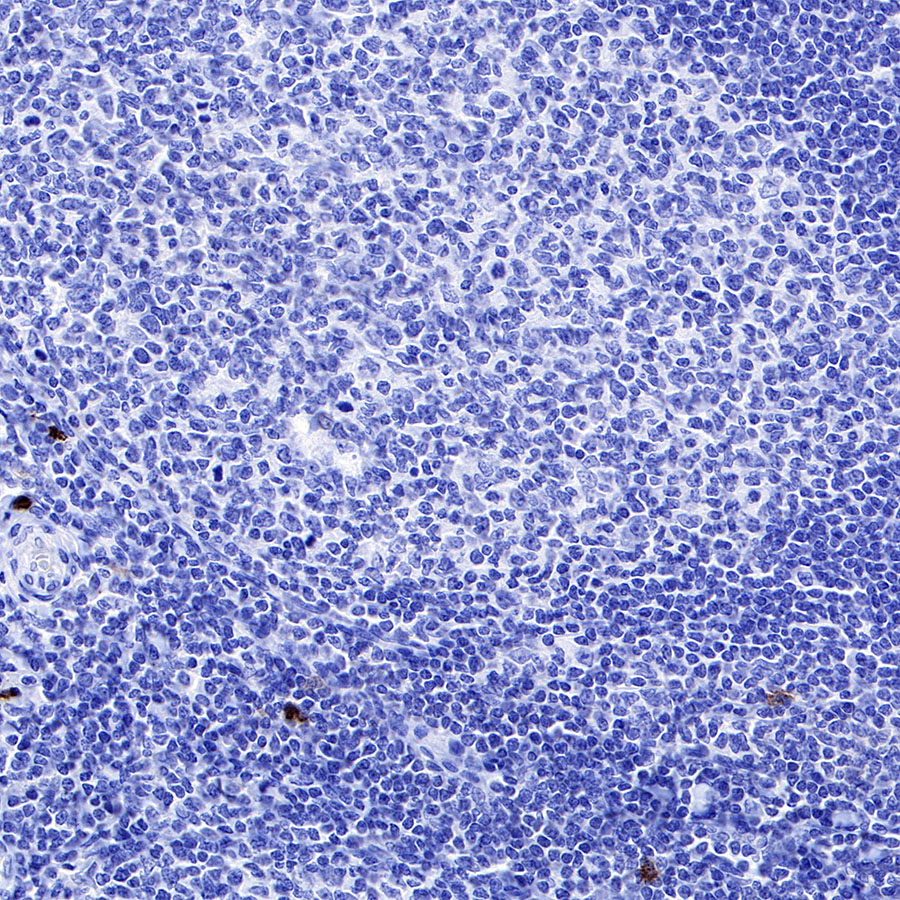 Rabbit anti-TPSAB1 Recombinant Monoclonal Antibody(R038)