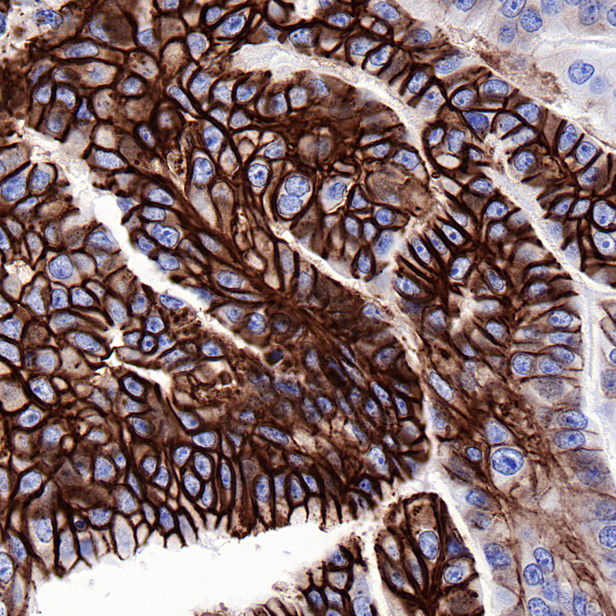Rabbit anti-GLUT1 Recombinant Monoclonal Antibody(R057)