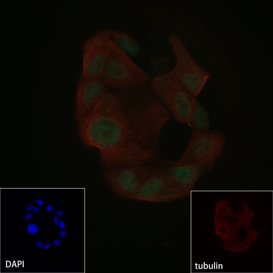 Rabbit anti-FOXP1 Recombinant Monoclonal Antibody(R053)