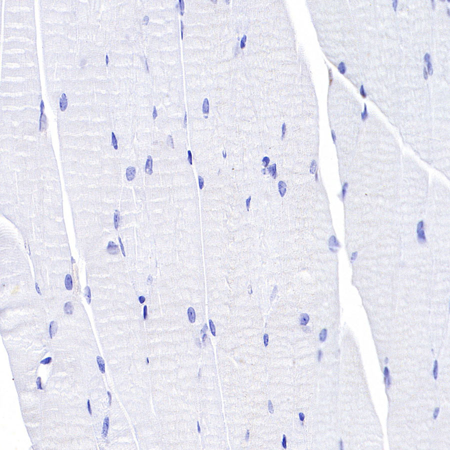 Rabbit anti-CD8α Recombinant Monoclonal Antibody(142-52)