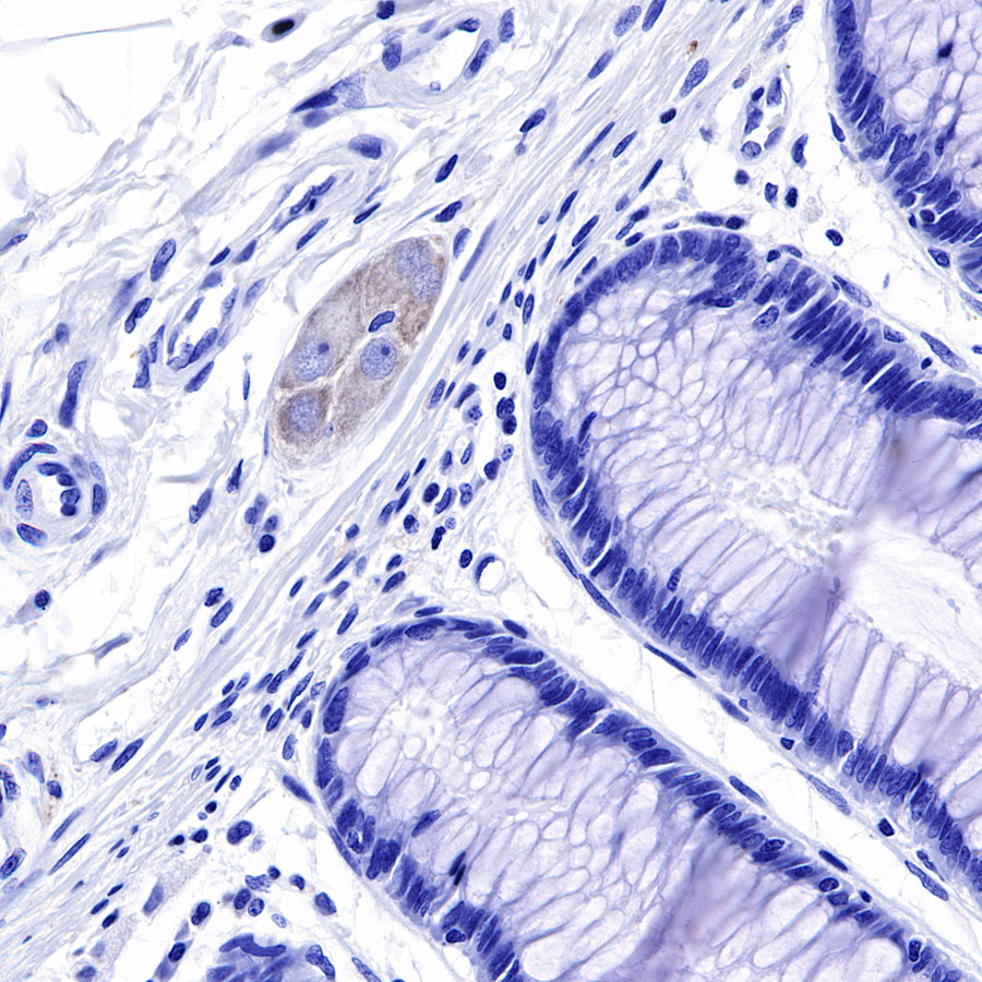 Rabbit anti-Tau Recombinant Monoclonal Antibody(171-67)
