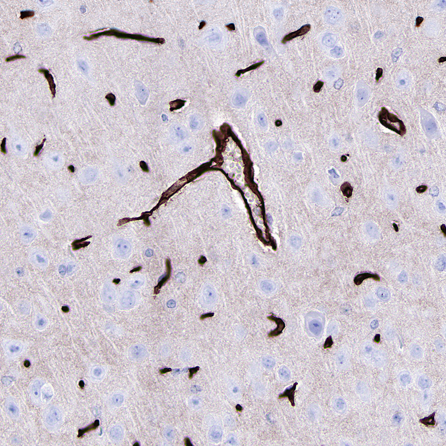 Rabbit anti-GLUT1 Recombinant Monoclonal Antibody(R057)