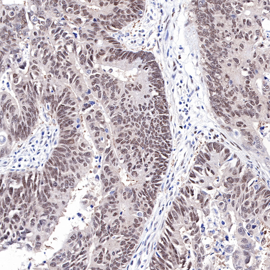 Rabbit anti-FOXP1 Recombinant Monoclonal Antibody(R053)