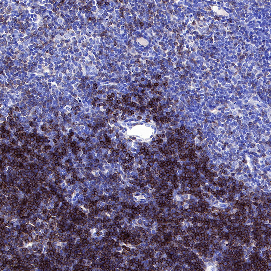 Rabbit anti-CD8α Recombinant Monoclonal Antibody(142-52)