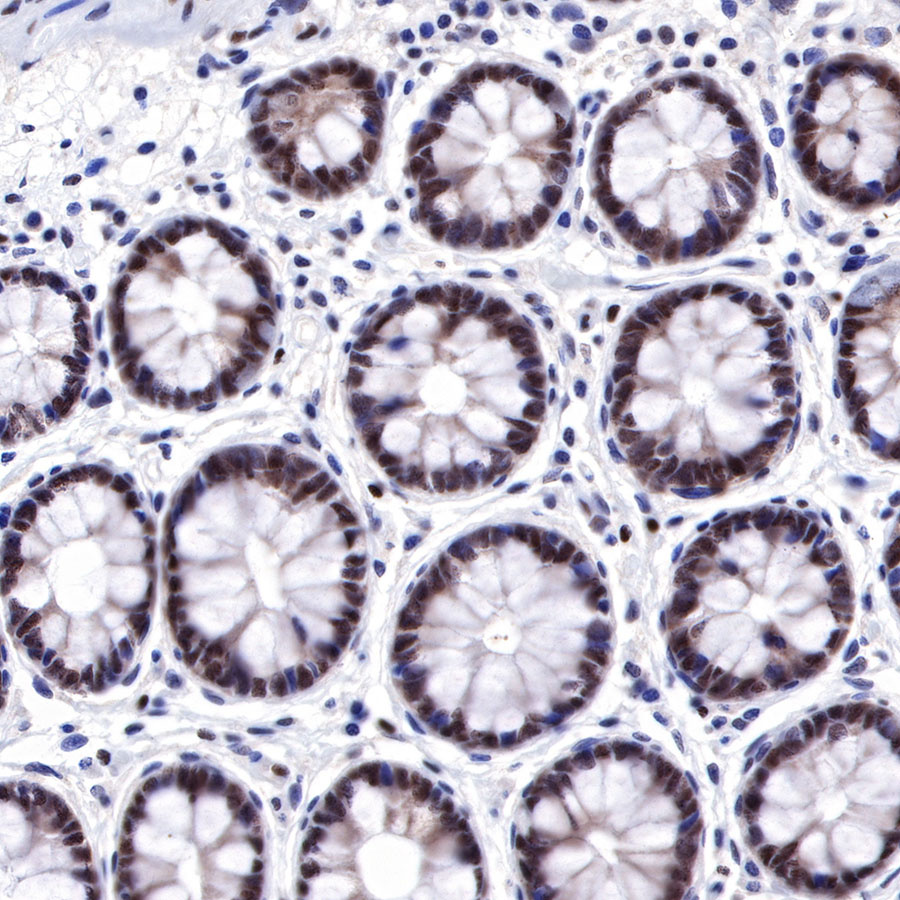 Rabbit anti-FOXP1 Recombinant Monoclonal Antibody(R053)