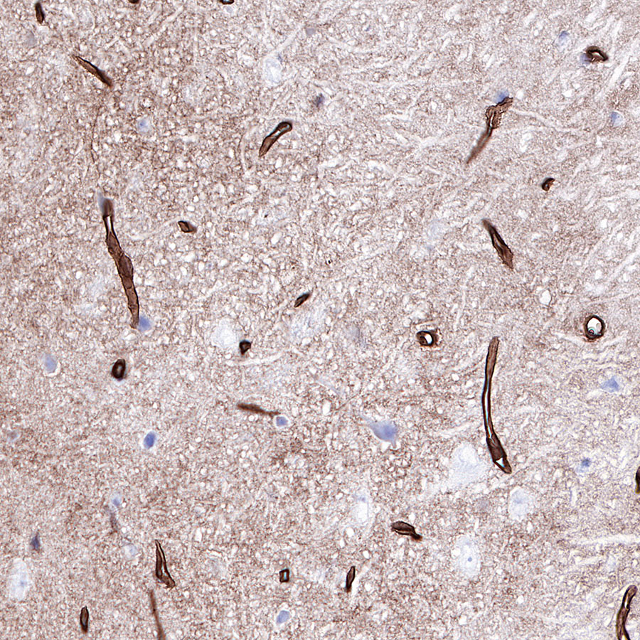 Rabbit anti-GLUT1 Recombinant Monoclonal Antibody(R057)