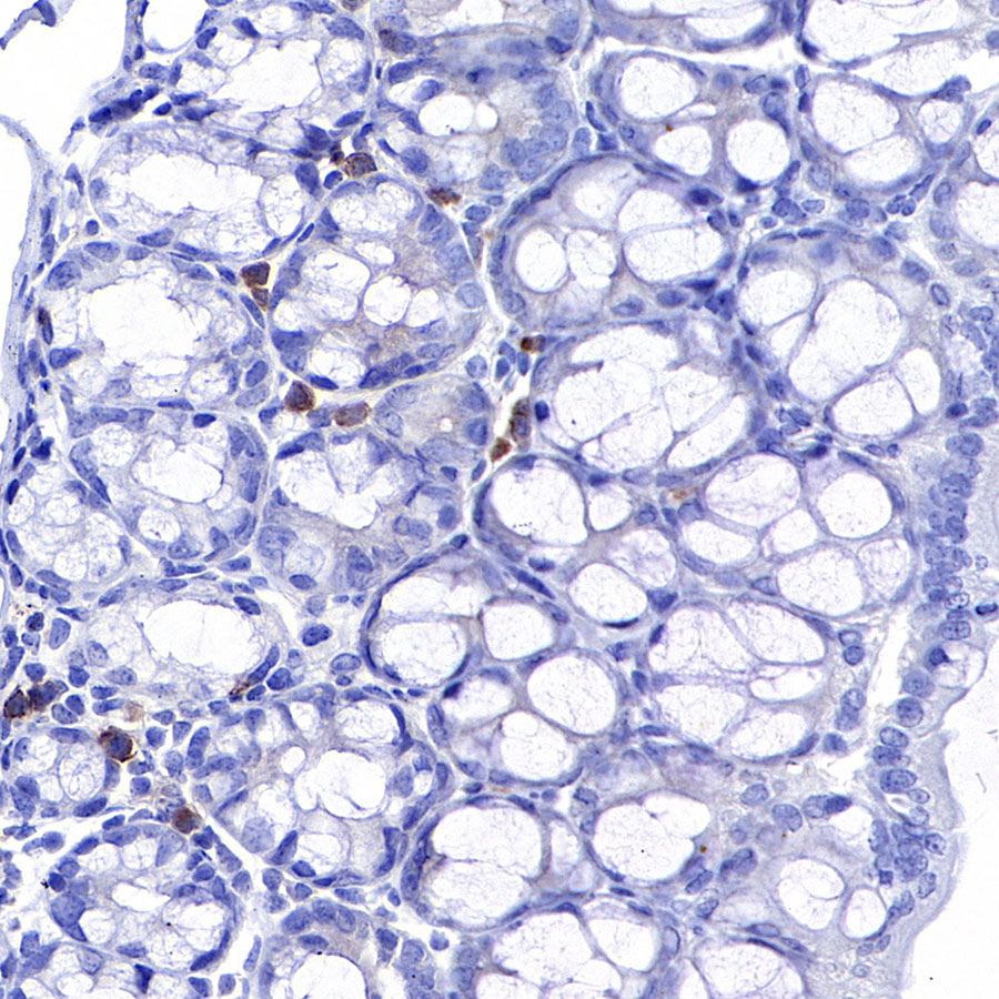Rabbit anti-CD8α Recombinant Monoclonal Antibody(142-52)