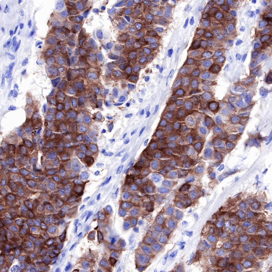 Rabbit anti-Tau Recombinant Monoclonal Antibody(171-67)