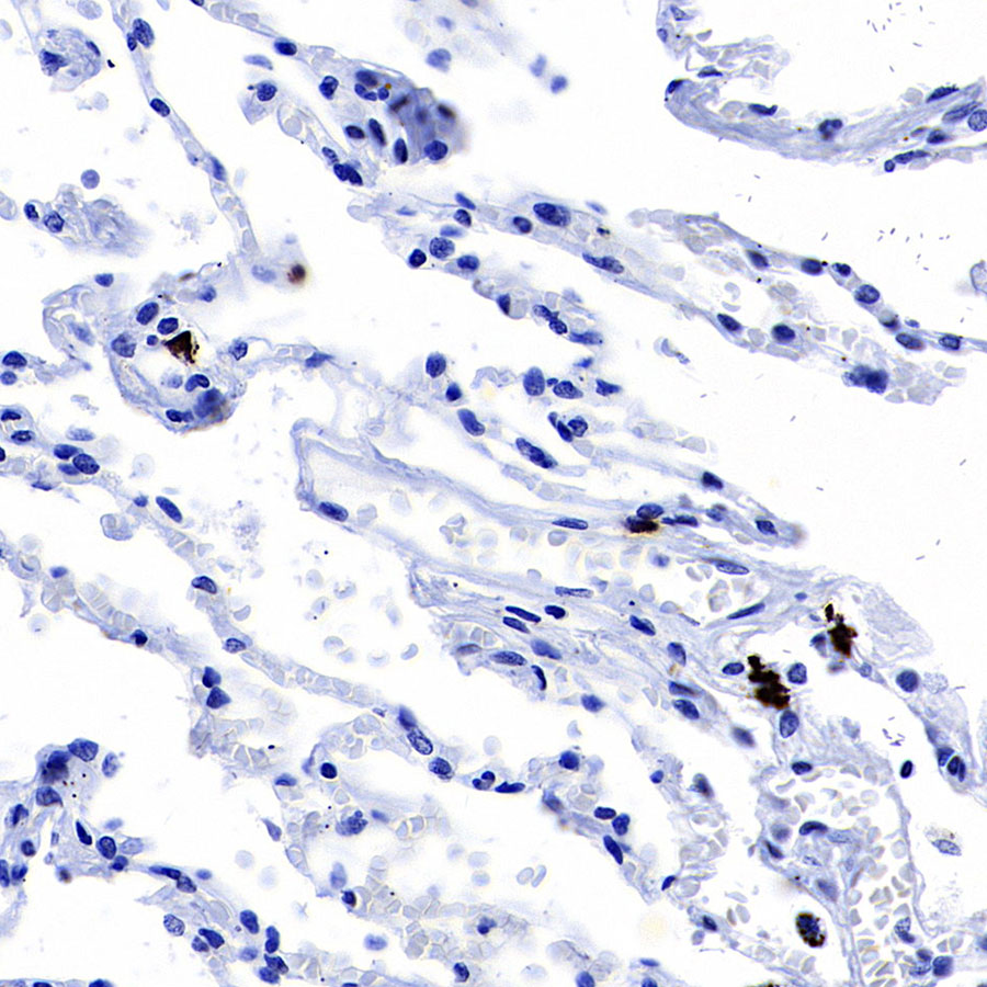 Rabbit anti-TPSAB1 Recombinant Monoclonal Antibody(R038)