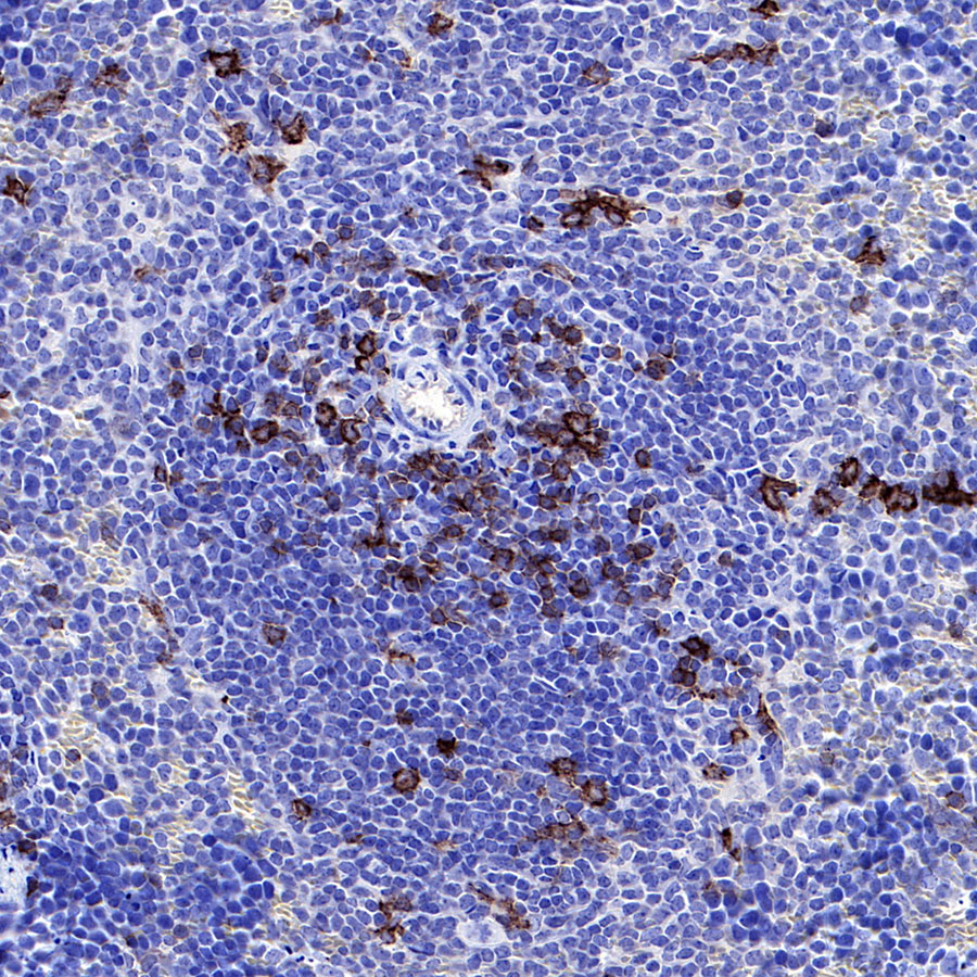 Rabbit anti-CD8α Recombinant Monoclonal Antibody(142-52)