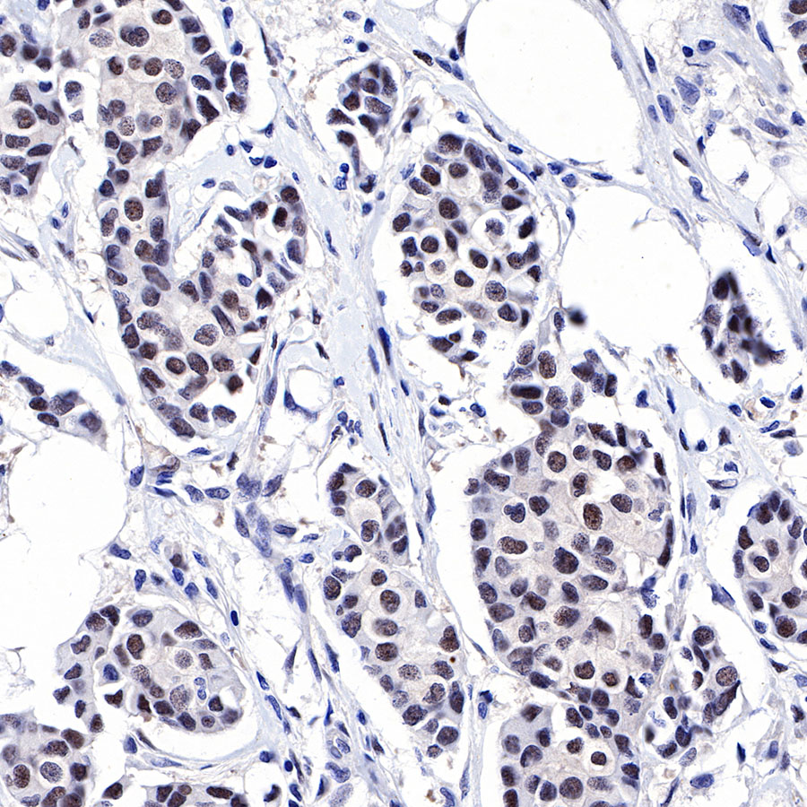 Rabbit anti-FOXP1 Recombinant Monoclonal Antibody(R053)