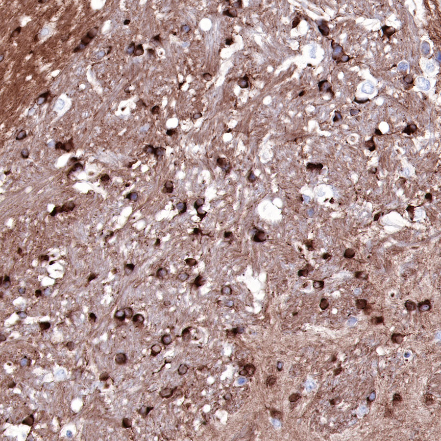 Rabbit anti-Tau Recombinant Monoclonal Antibody(171-67)