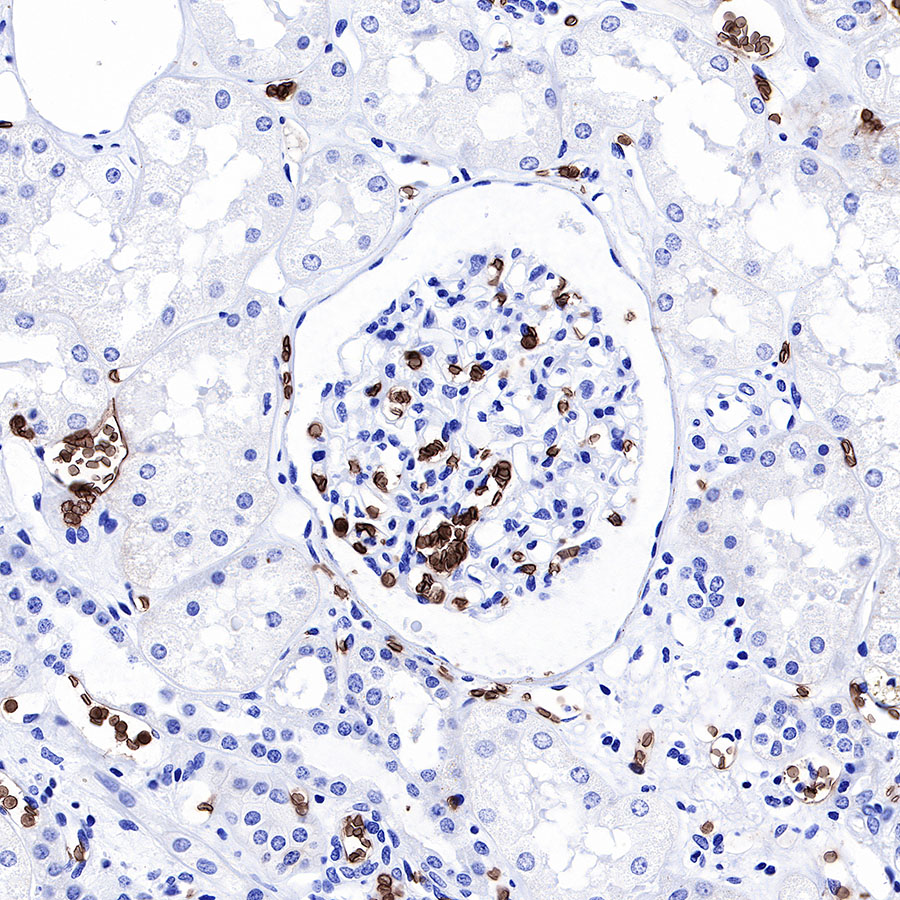 Rabbit anti-GLUT1 Recombinant Monoclonal Antibody(R057)