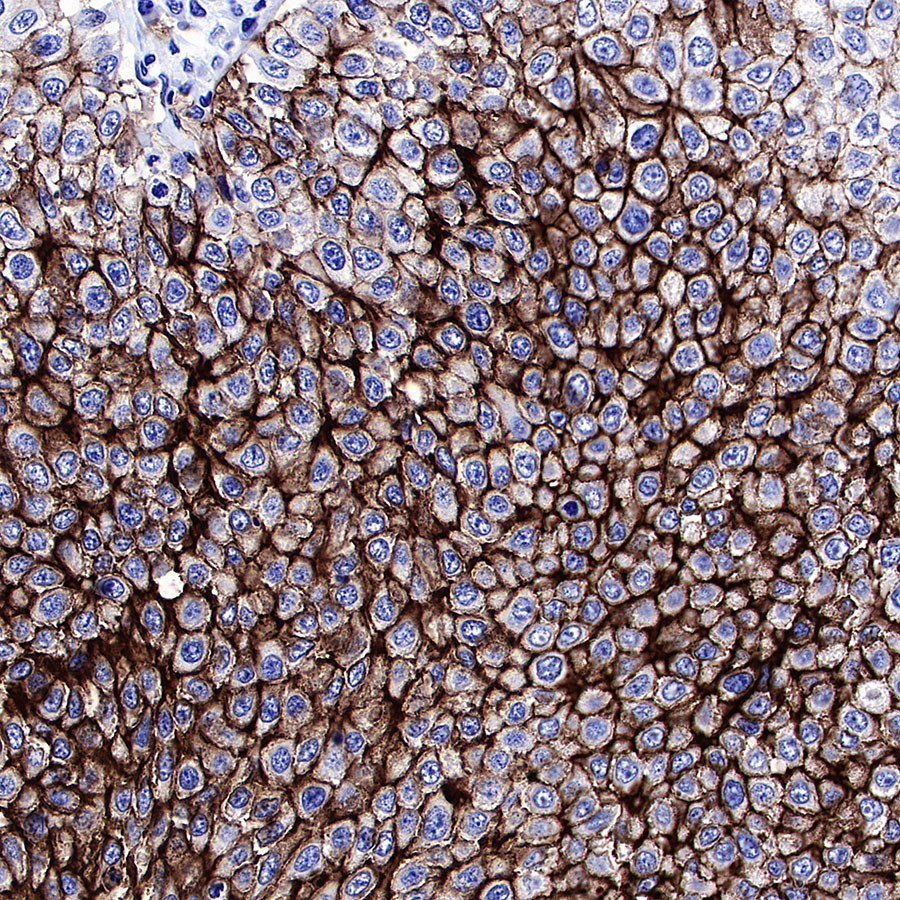 Rabbit anti-GLUT1 Recombinant Monoclonal Antibody(R057)
