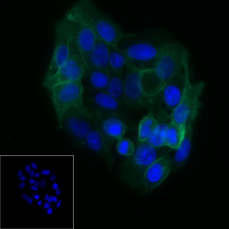 Rabbit anti-GLUT1 Recombinant Monoclonal Antibody(R057)