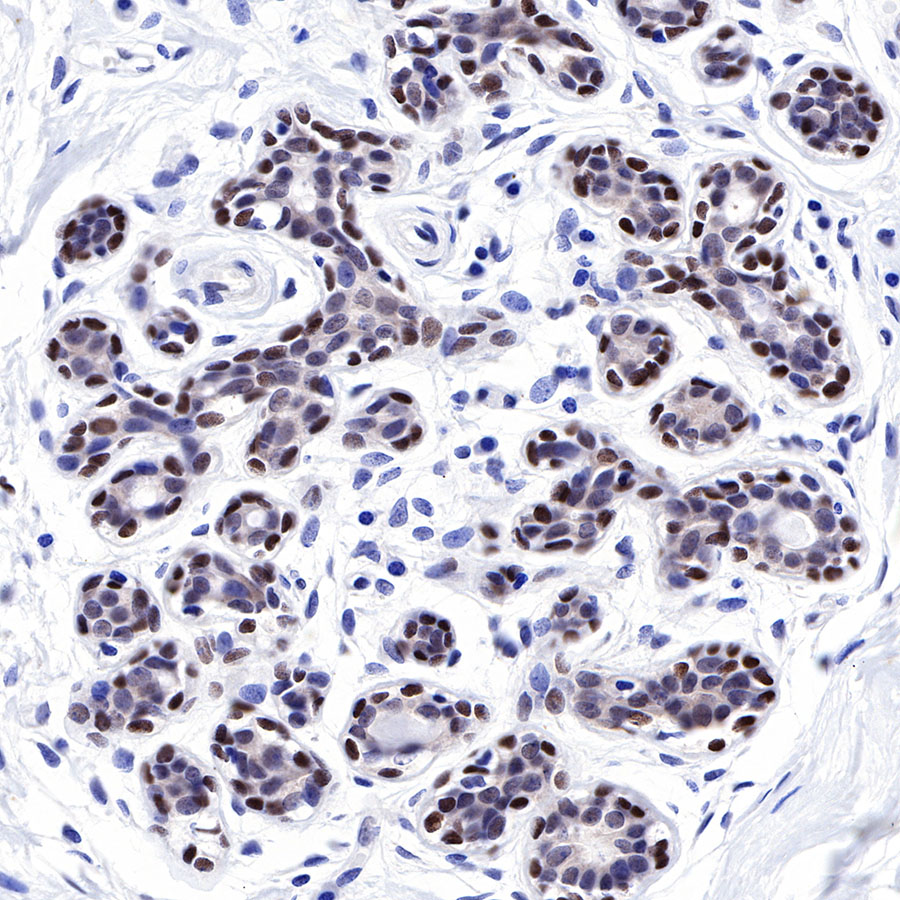 Rabbit anti-FOXP1 Recombinant Monoclonal Antibody(R053)