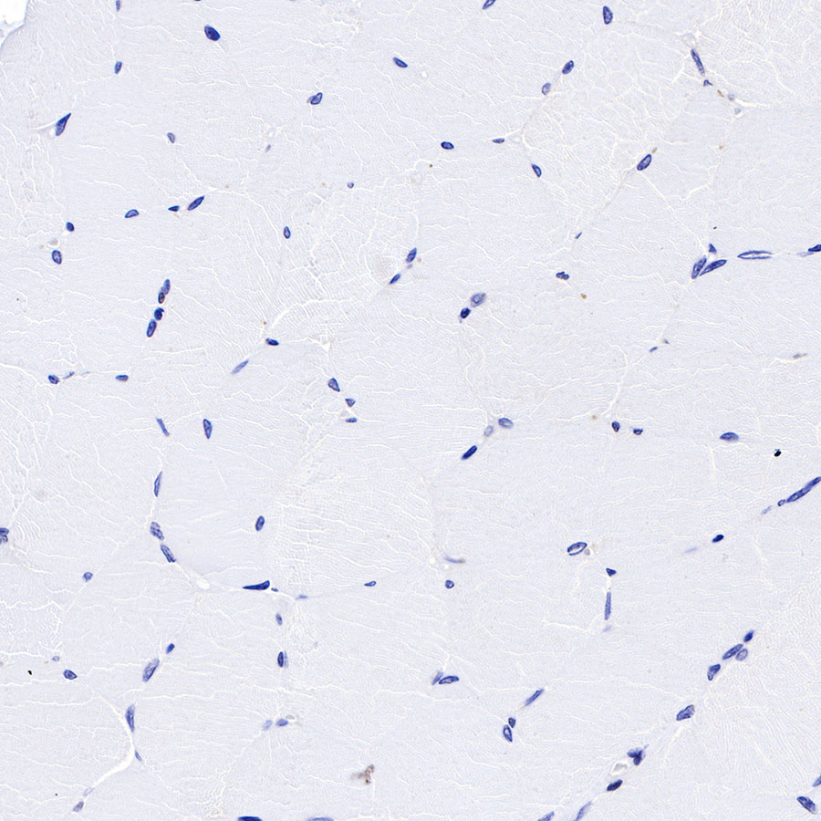 Rabbit anti-FOXP1 Recombinant Monoclonal Antibody(R053)