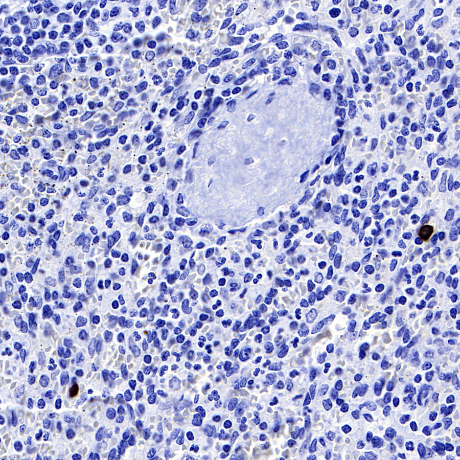 Rabbit anti-TPSAB1 Recombinant Monoclonal Antibody(R038)