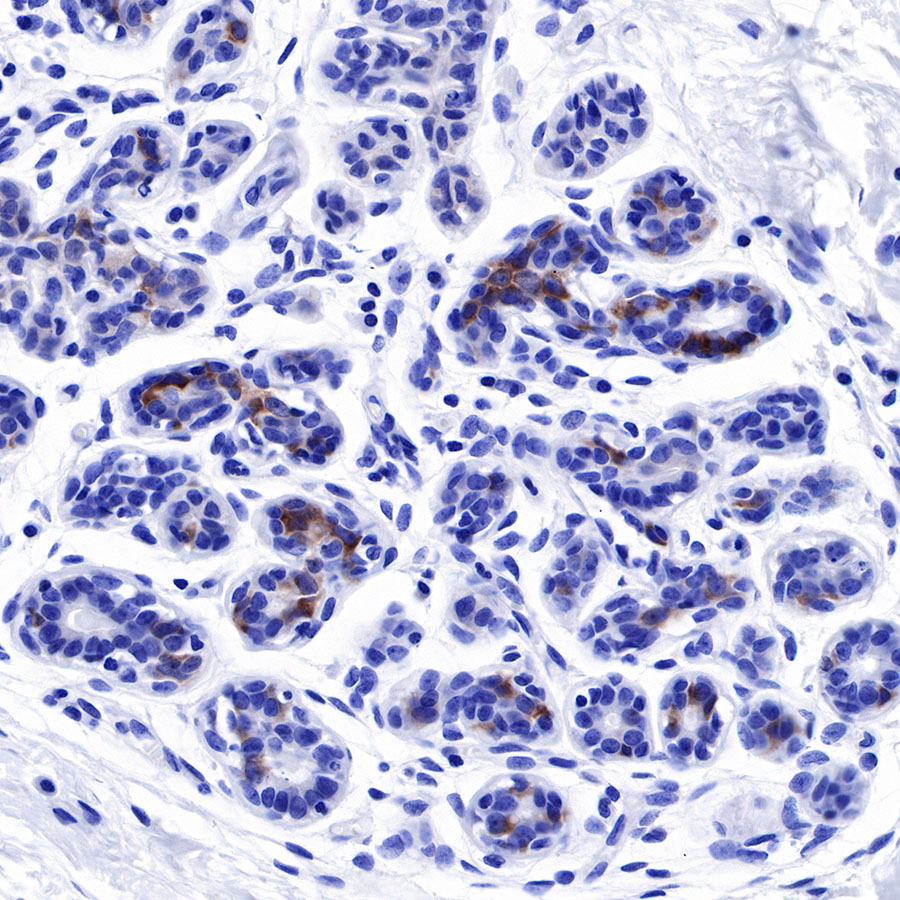 Rabbit anti-Tau Recombinant Monoclonal Antibody(171-67)