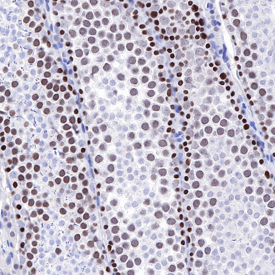 Rabbit anti-MSH6 Recombinant Monoclonal Antibody(R094)