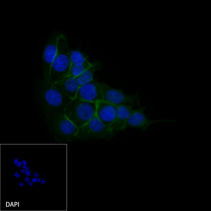 Rabbit anti-E-Cadherin Recombinant Monoclonal Antibody(R088)