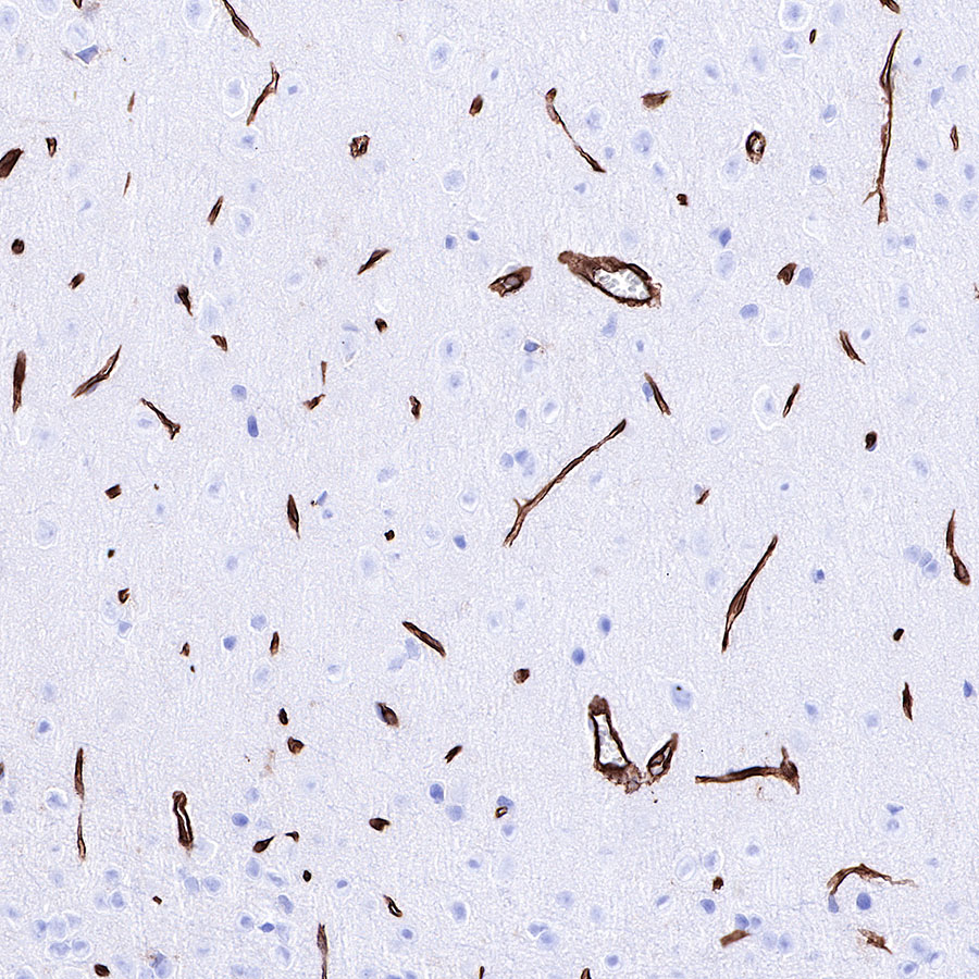 Rabbit anti-Caveolin-1 Recombinant Monoclonal Antibody(065-20)