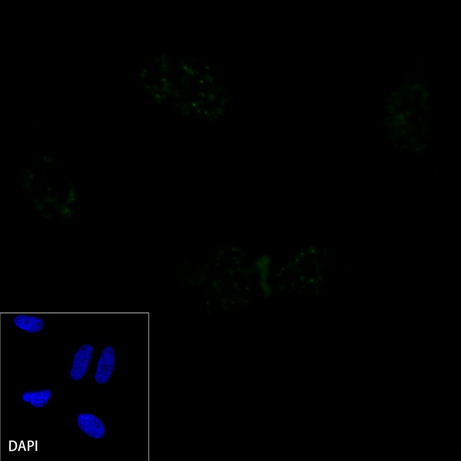 Rabbit anti-DLL3 Recombinant Monoclonal Antibody(207-59)