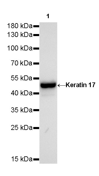 Rabbit anti-Keratin 17 Recombinant Monoclonal Antibody(011-43)