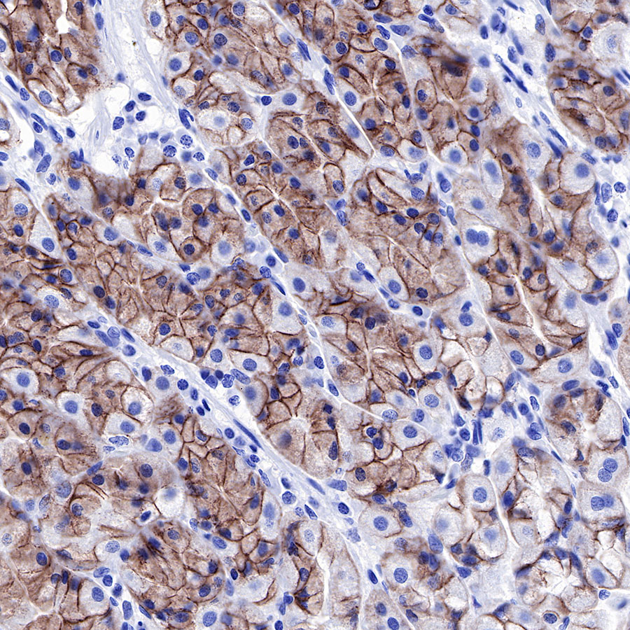 Rabbit anti-E-Cadherin Recombinant Monoclonal Antibody(R088)