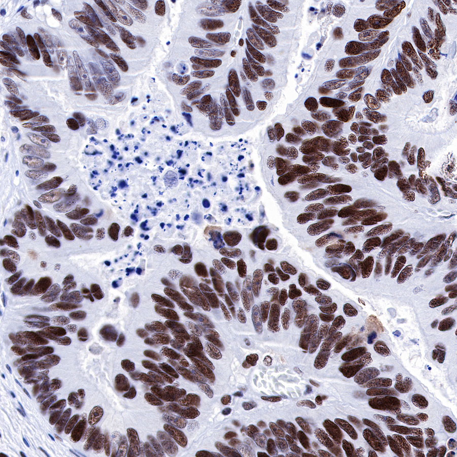 Rabbit anti-MSH6 Recombinant Monoclonal Antibody(R094)