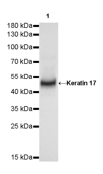 Rabbit anti-Keratin 17 Recombinant Monoclonal Antibody(011-43)