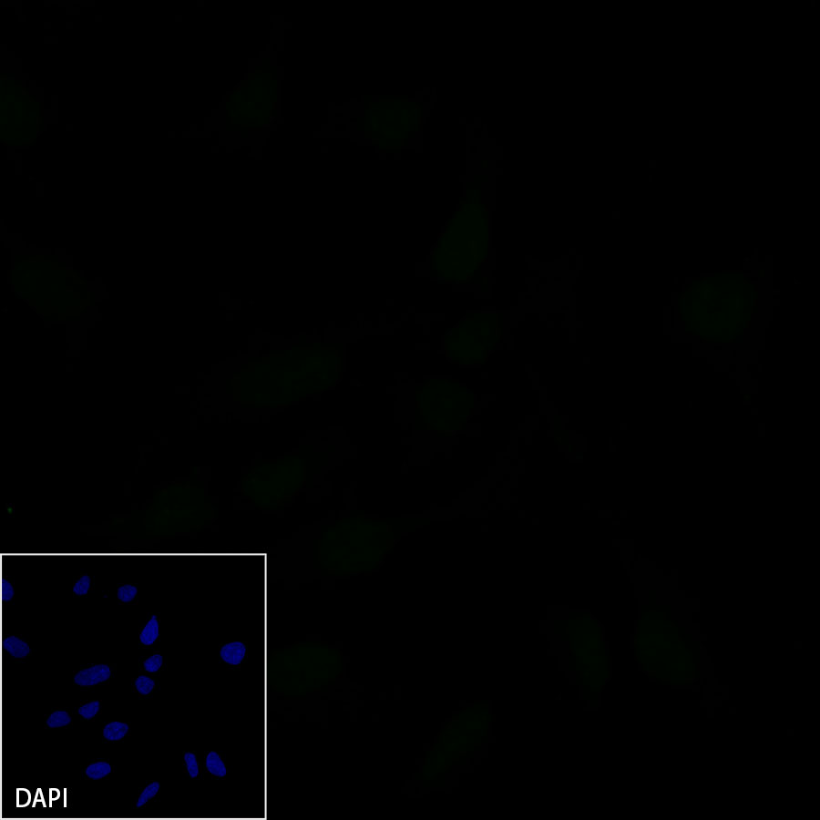 Rabbit anti-E-Cadherin Recombinant Monoclonal Antibody(R088)