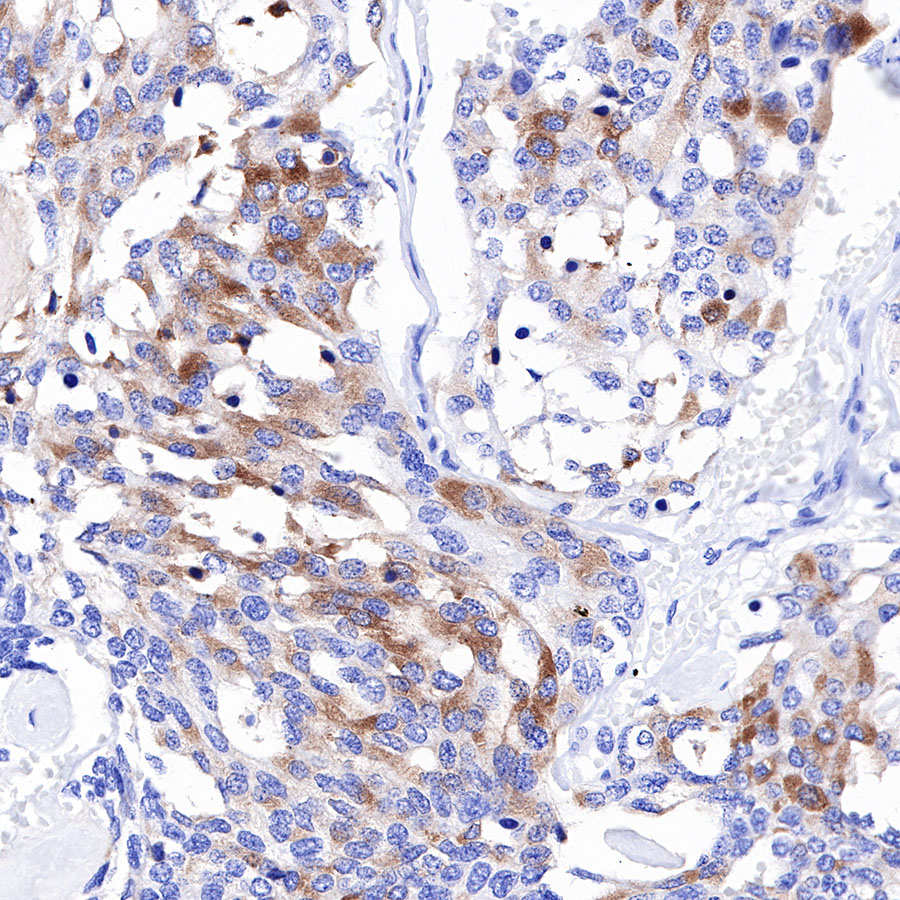 Rabbit anti-DLL3 Recombinant Monoclonal Antibody(207-59)