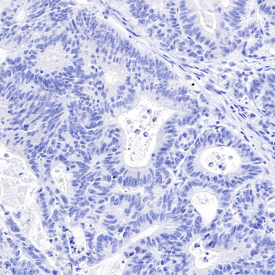 Rabbit anti-DLL3 Recombinant Monoclonal Antibody(207-59)