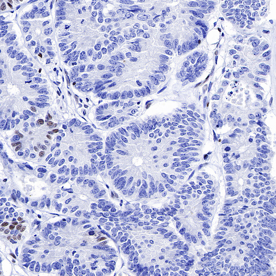 Rabbit anti-MSH6 Recombinant Monoclonal Antibody(R094)