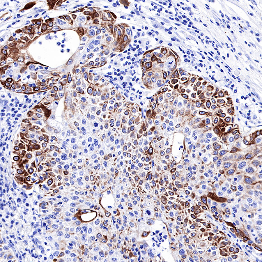 Rabbit anti-Keratin 17 Recombinant Monoclonal Antibody(011-43)