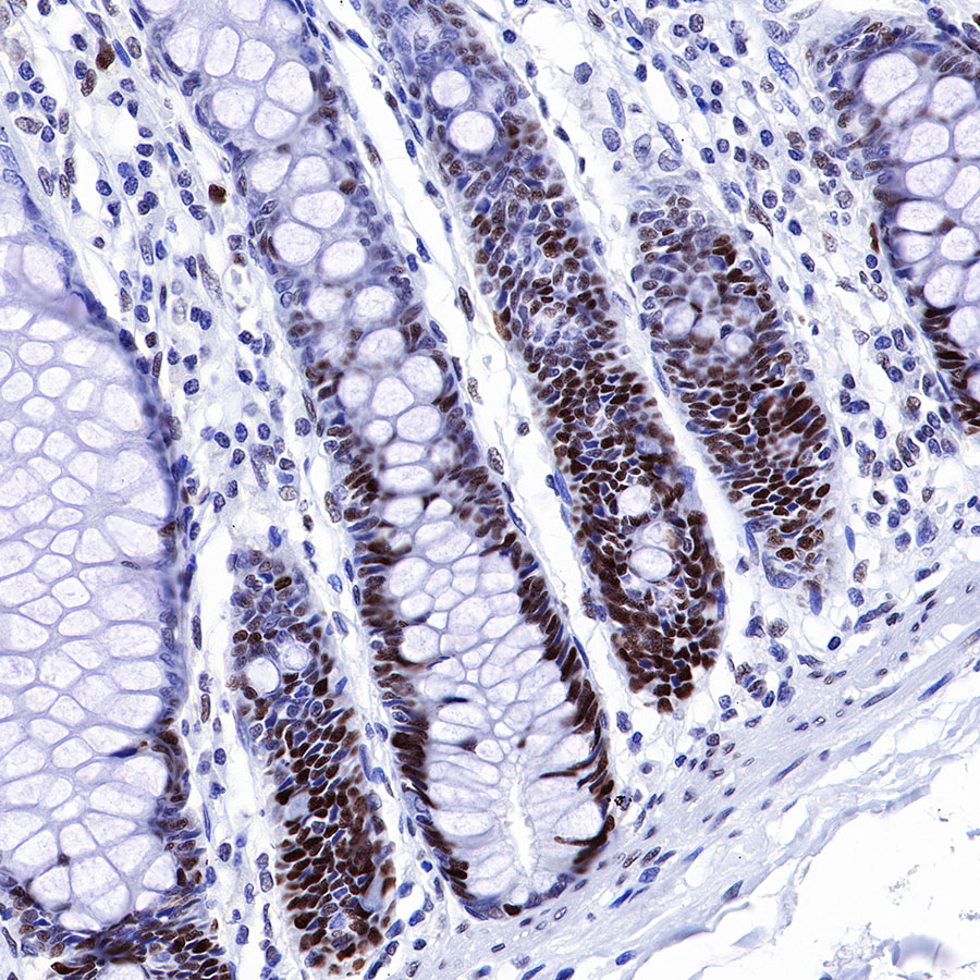 Rabbit anti-MSH6 Recombinant Monoclonal Antibody(R094)