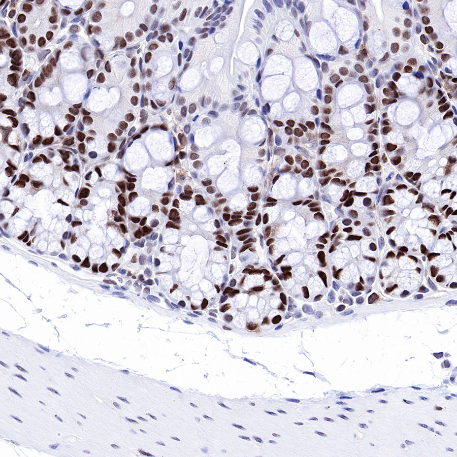 Rabbit anti-MSH6 Recombinant Monoclonal Antibody(R094)