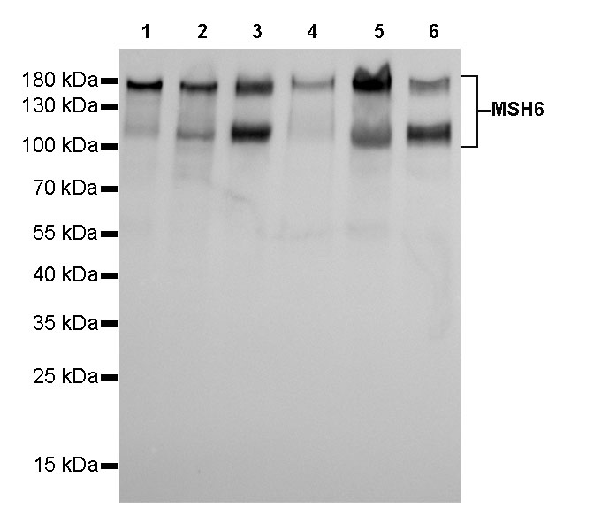 Rabbit anti-MSH6 Recombinant Monoclonal Antibody(R094)