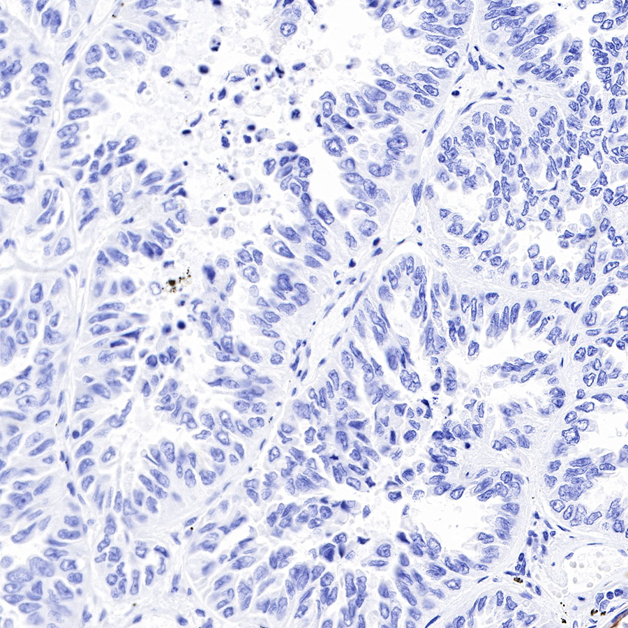 Rabbit anti-Keratin 17 Recombinant Monoclonal Antibody(011-43)
